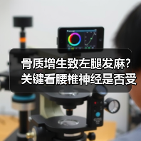 骨质增生致左腿发麻？关键看腰椎神经是否受压（图3）