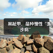 黑趾甲，是种慢性“跑步病”