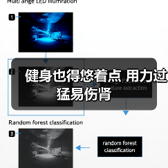 健身也得悠着点 用力过猛易伤肾（图3）