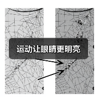 运动让眼睛更明亮（图2）