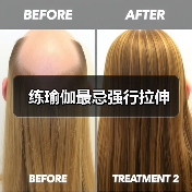 练瑜伽最忌强行拉伸（图4）