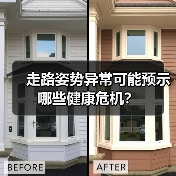 走路姿势异常可能预示哪些健康危机？（图3）