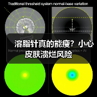 溶脂针真的能瘦？小心皮肤溃烂风险