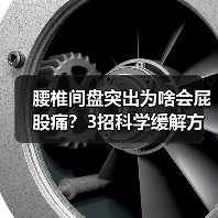 腰椎间盘突出为啥会屁股痛?3招科学缓解方法(图4) 腰椎间盘突出为啥会屁股痛?3招科学缓解方法(图4)