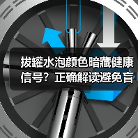 拔罐水泡颜色暗藏健康信号?正确解读避免盲目焦虑(图4) 拔罐水泡颜色暗藏健康信号?正确解读避免盲目焦虑(图4)