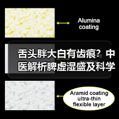 舌头胖大白有齿痕?中医解析脾虚湿盛及科学调理方案(图3) 舌头胖大白有齿痕?中医解析脾虚湿盛及科学调理方案(图3)