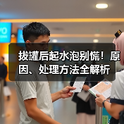 拔罐后起水泡别慌!原因、处理方法全解析(图4) 拔罐后起水泡别慌!原因、处理方法全解析(图4)