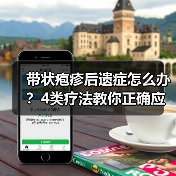 带状疱疹后遗症怎么办?4类疗法教你正确应对(图2) 带状疱疹后遗症怎么办?4类疗法教你正确应对(图2)