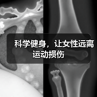 科学健身,让女性远离运动损伤(图4) 科学健身,让女性远离运动损伤(图4)