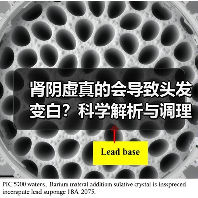 肾阴虚真的会导致头发变白?科学解析与调理全攻略(图3) 肾阴虚真的会导致头发变白?科学解析与调理全攻略(图3)