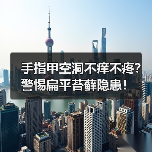 手指甲空洞不痒不疼？警惕扁平苔藓隐患！（图4）
