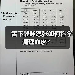 舌下静脉怒张如何科学调理血瘀？（图3）