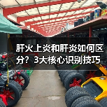肝火上炎和肝炎如何区分?3大核心识别技巧(图2) 肝火上炎和肝炎如何区分?3大核心识别技巧(图2)