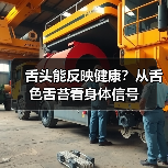 舌头能反映健康?从舌色舌苔看身体信号(图3) 舌头能反映健康?从舌色舌苔看身体信号(图3)