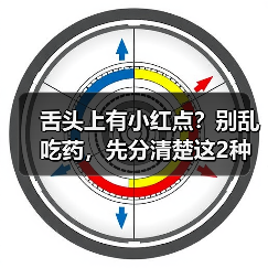 舌头上有小红点?别乱吃药,先分清楚这2种情况(图4) 舌头上有小红点?别乱吃药,先分清楚这2种情况(图4)
