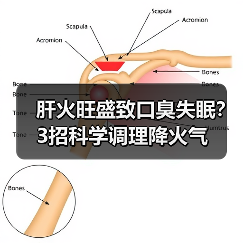 肝火旺盛致口臭失眠?3招科学调理降火气(图1) 肝火旺盛致口臭失眠?3招科学调理降火气(图1)