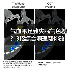 气血不足致失眠气色差?3招综合调理帮你改善(图2) 气血不足致失眠气色差?3招综合调理帮你改善(图2)