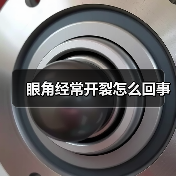 眼角经常开裂怎么回事(图1) 眼角经常开裂怎么回事(图1)