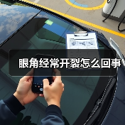 眼角经常开裂怎么回事(图3) 眼角经常开裂怎么回事(图3)