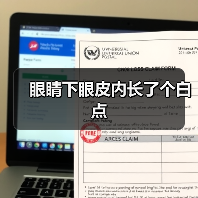 眼睛下眼皮内长了个白点(图2) 眼睛下眼皮内长了个白点(图2)