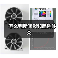 怎么判断咽炎和扁桃体炎(图3) 怎么判断咽炎和扁桃体炎(图3)