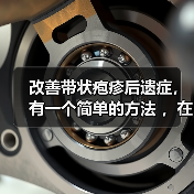 改善带状疱疹后遗症,有一个简单的方法 ,在家就可以做,操作简单,只需要……(图4) 改善带状疱疹后遗症,有一个简单的方法 ,在家就可以做,操作简单,只需要……(图4)